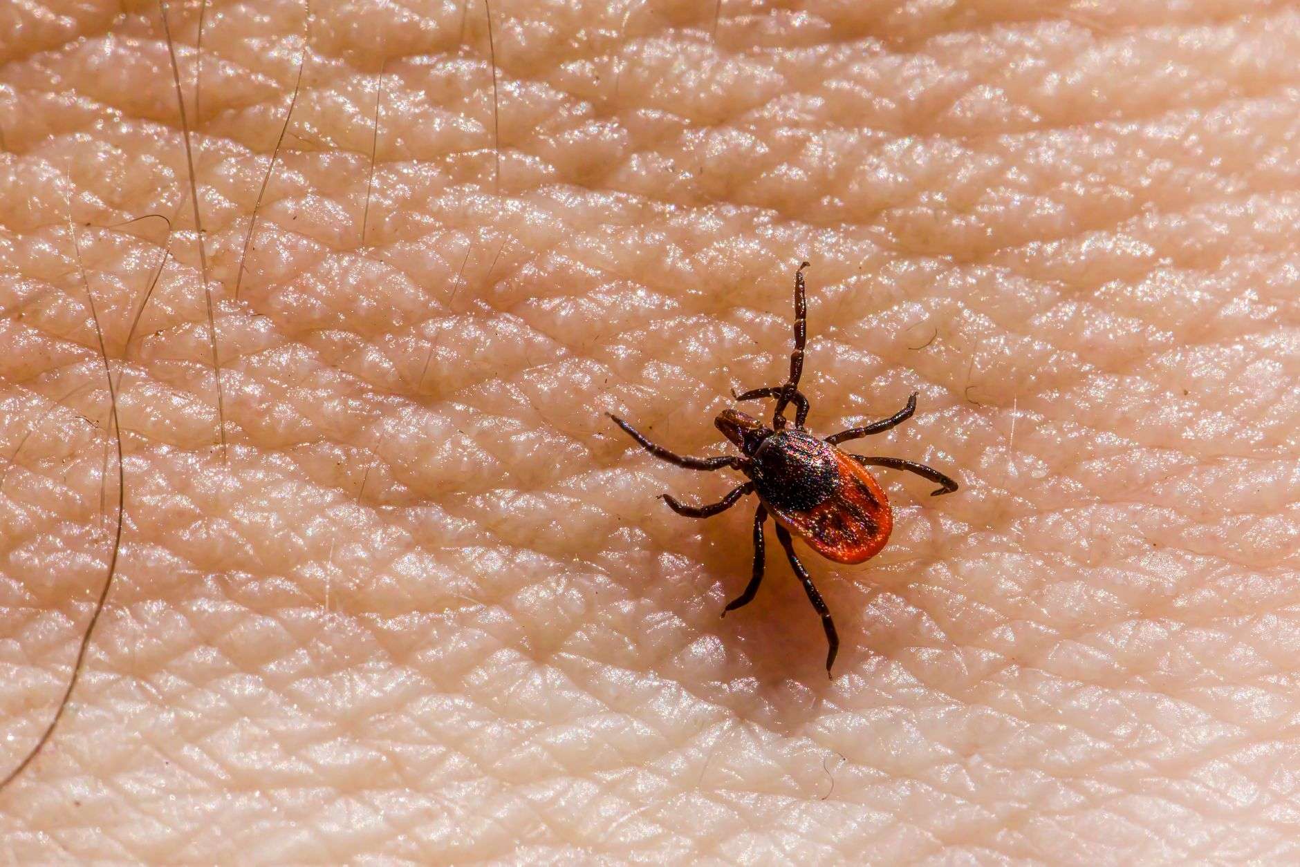 a tick is on the skin of a person